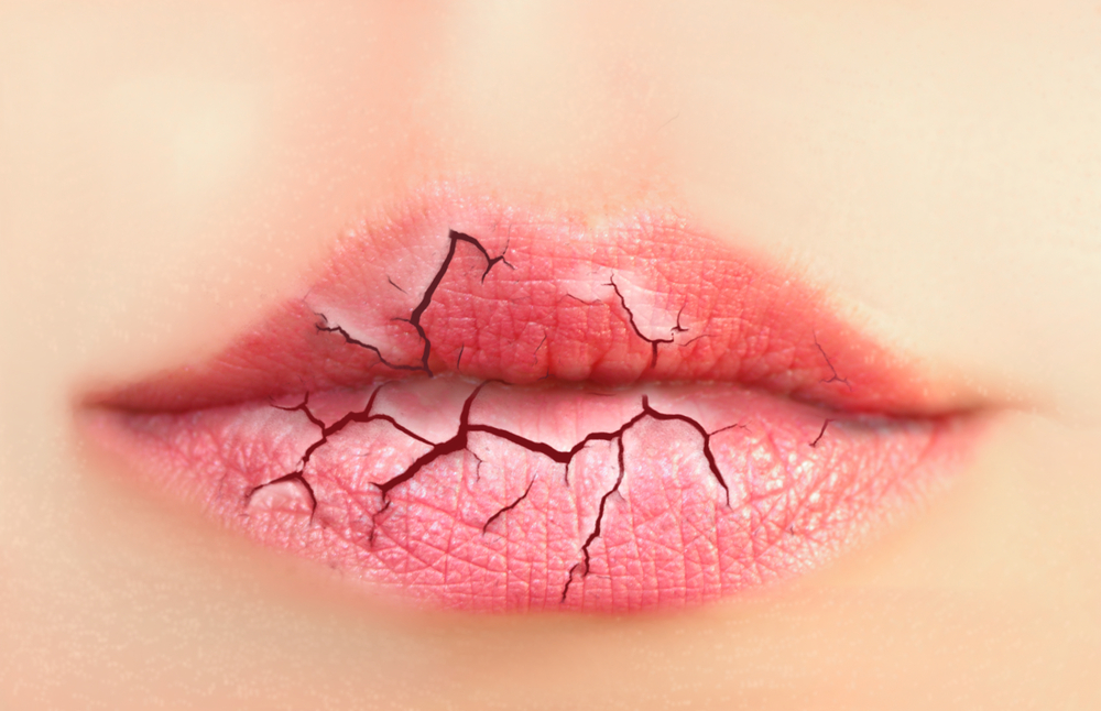 4 nguyên vẹn nhân khiến cho thô môi
