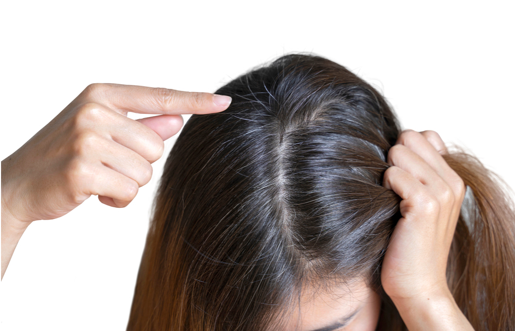 Nguyên nhân tóc bạc sớm ở nam giới là gì Cách khắc phục ra sao