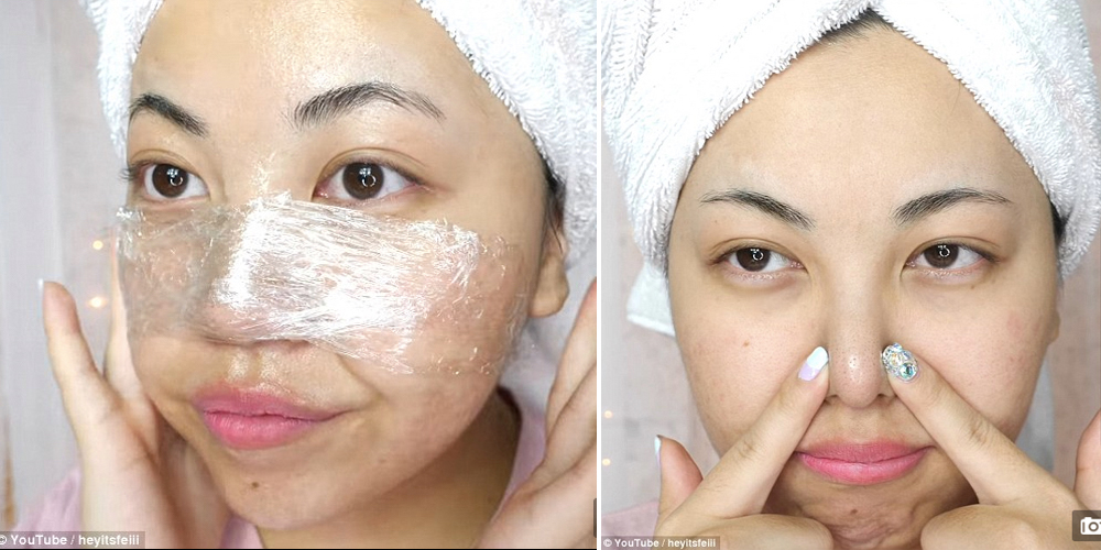 beauty blogger Fei Yang trị mụn đầu đen bằng vaseline