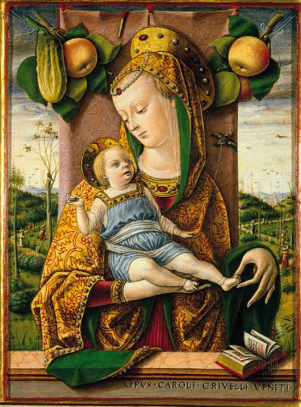 Bức Madonna and Child của họa sĩ người Ý Carlo Crivelli vẽ vào thời Phục hưng. Ảnh: MET Museum. Chứng rụng tóc 