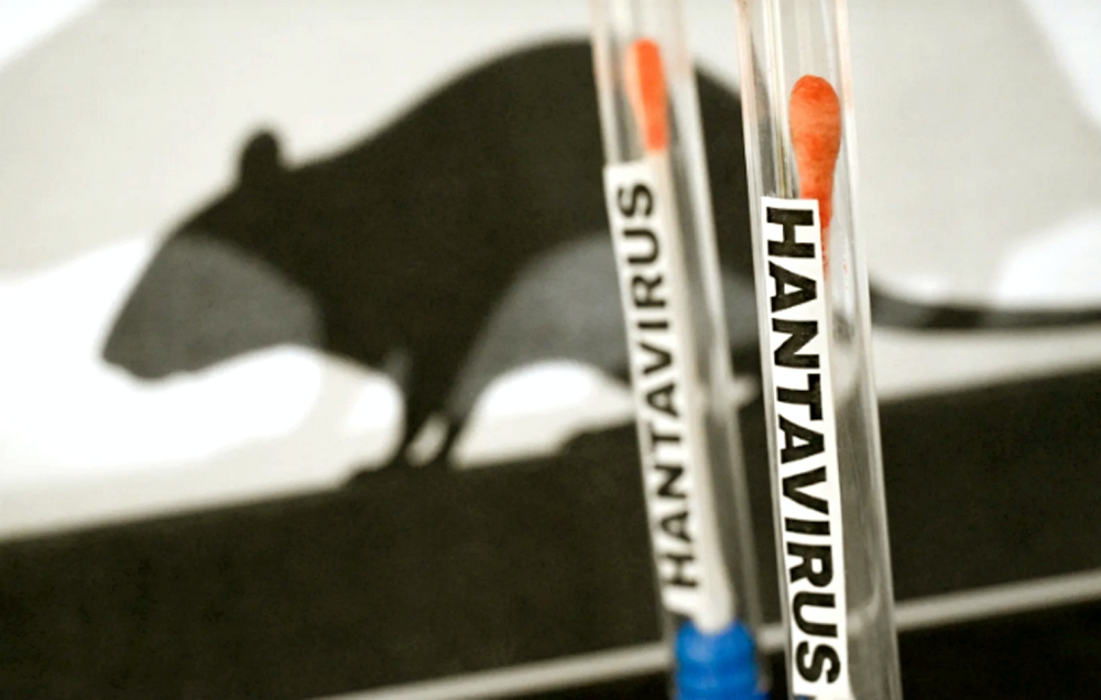 Các triệu chứng nhiễm hantavirus
